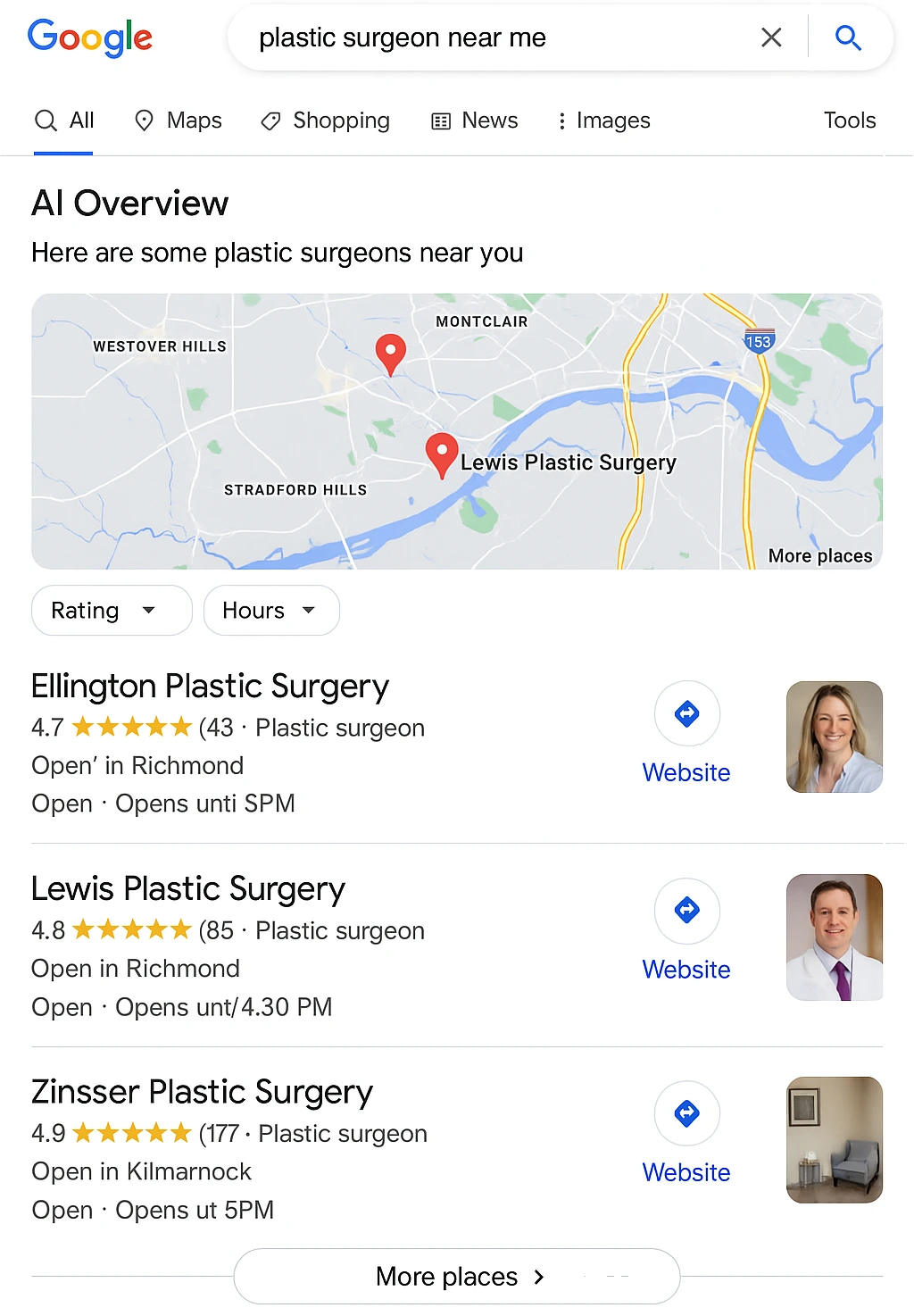 Local SEO for Plastic Surgeons